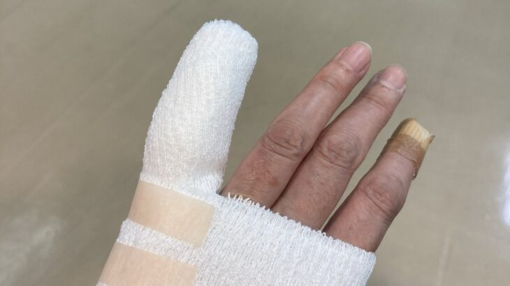 自認では再燃認定はしてないけど